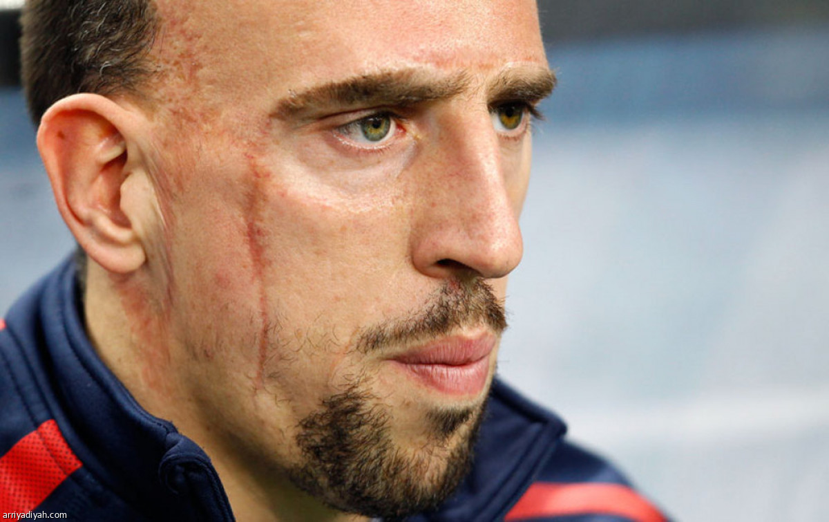 /media/iris/franck-ribery-pl.jpg