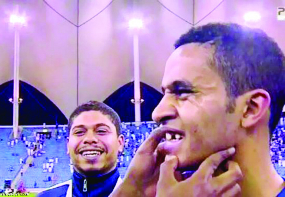 كسر سن البريك لا يحدث إلا في حلبات الملاكمة